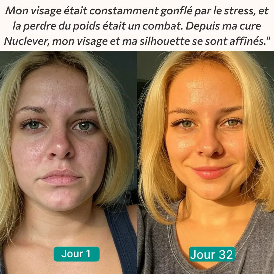 Nuclever Cortisol Manager™